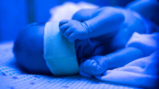 Newborn having a treatment for jaundice under ultraviolet lamp in home bed