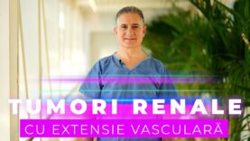 TUMORI RENALE CU EXTENSIE VASCULARĂ