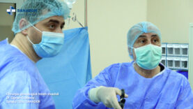 Chirurgia ginecologică minim invazivă.00_02_03_15.Still002