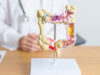 Doctor with human Colon anatomy model. Colonic disease, Large In