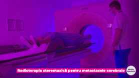 stereotaxia pt. metastaze cerebrale.00_00_12_19.Still002