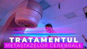 TRATAMENTUL METASTAZELOR CEREBRALE