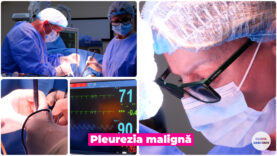 PLEUREZIA MALIGNA.00_00_29_24.Still002