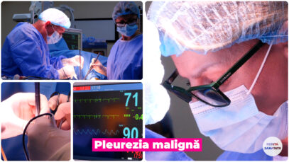 PLEUREZIA MALIGNA.00_00_29_24.Still002