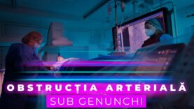 OBSTRUCȚIA ARTERIALĂ SUB GENUNCHI