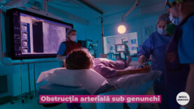 obstrucția arterială sub genunchi.00_00_11_12.Still002