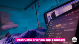 obstrucția arterială sub genunchi.00_02_20_03.Still004