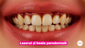 PARODONTOZA SEPT 2025.00_01_29_00.Still006