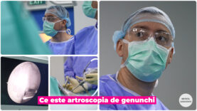 ARTROSCOPIA DE GENUNCHI.00_00_27_14.Still003