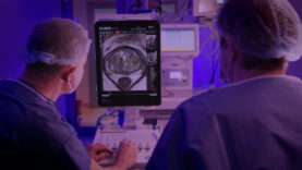 Diagnostic și tratament pentru cancer de prostată.00_11_49_32.Still005