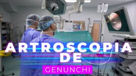 ARTROSCOPIA DE GENUNCHI