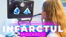 INFARCTUL MIOCARDIC