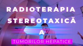 RADIOTERAPIA STEREOTAXICĂ A TUMORILOR HEPATICE #radioterapia #tumori #cancerhepatic