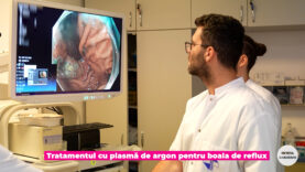 Procedura ARMA.00_07_43_24.Still003