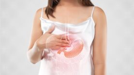 A woman suffering from gastroesophageal reflux disease