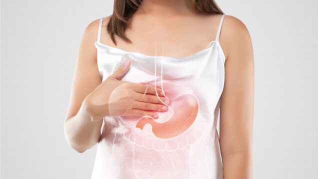 A woman suffering from gastroesophageal reflux disease