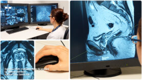 Examenul RMN multiparametric de prostată.00_03_15_25.Still003