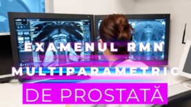 EXAMENUL RMN MULTIPARAMETRIC DE PROSTATĂ