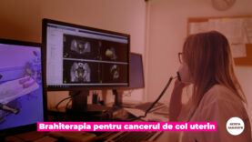 BRAHITERAPIA PT CANCERUL DE COL UTERIN.00_01_10_23.Still005