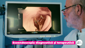 ECOENDOSCOPIA.00_01_08_05.Still004