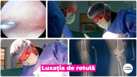 LUXATIA DE ROTULA.00_00_44_04.Still004