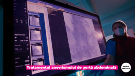 EVAR.00_02_41_04.Still004