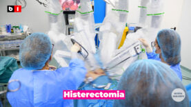 Histerectomia.00_00_11_20.Still003