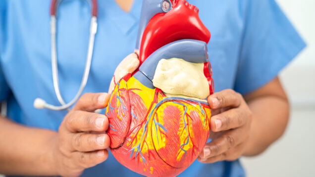 Cardiovascular disease CVD, Asian doctor holding human anatomy m