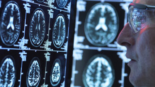 Doctor viewing brain scans for possible disease or damage in clinic