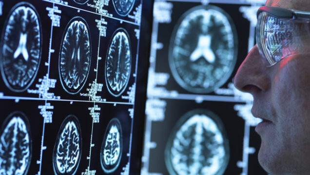 Doctor viewing brain scans for possible disease or damage in clinic