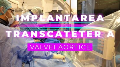 INLOCUIREA TRANSCATETER A VALVEI AORTICE (TAVI)