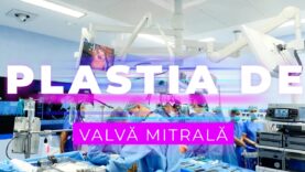PLASTIA DE VALVĂ MITRALĂ