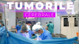 TUMORILE CEREBRALE