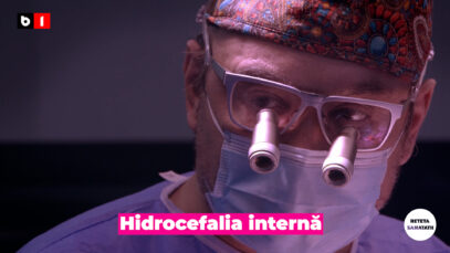Hidrocefalia internă.00_00_16_15.Still002