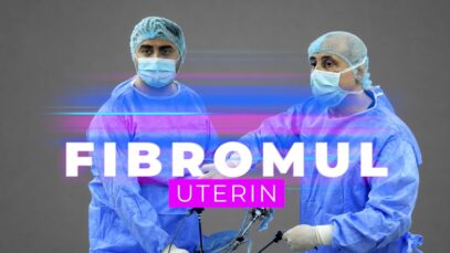FIBROMUL UTERIN