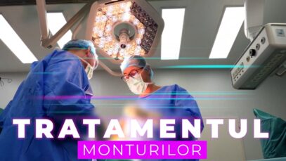 TRATAMENTUL MONTURILOR