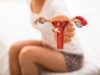 unrecognizing woman with abdominal pain holds the anatomical model of uterus and ovaries with pathology. diseases uterus and ovaries, endometriosis, ovarian cysts