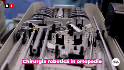 Chirurgia robotică în ortopedie.00_00_23_00.Still005