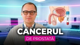 Cancerul de prostată: simptome, diagnostic și tratament