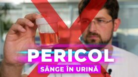 Hematuria: Ce înseamnă sângele în urină și când trebuie să ne îngrijorăm?